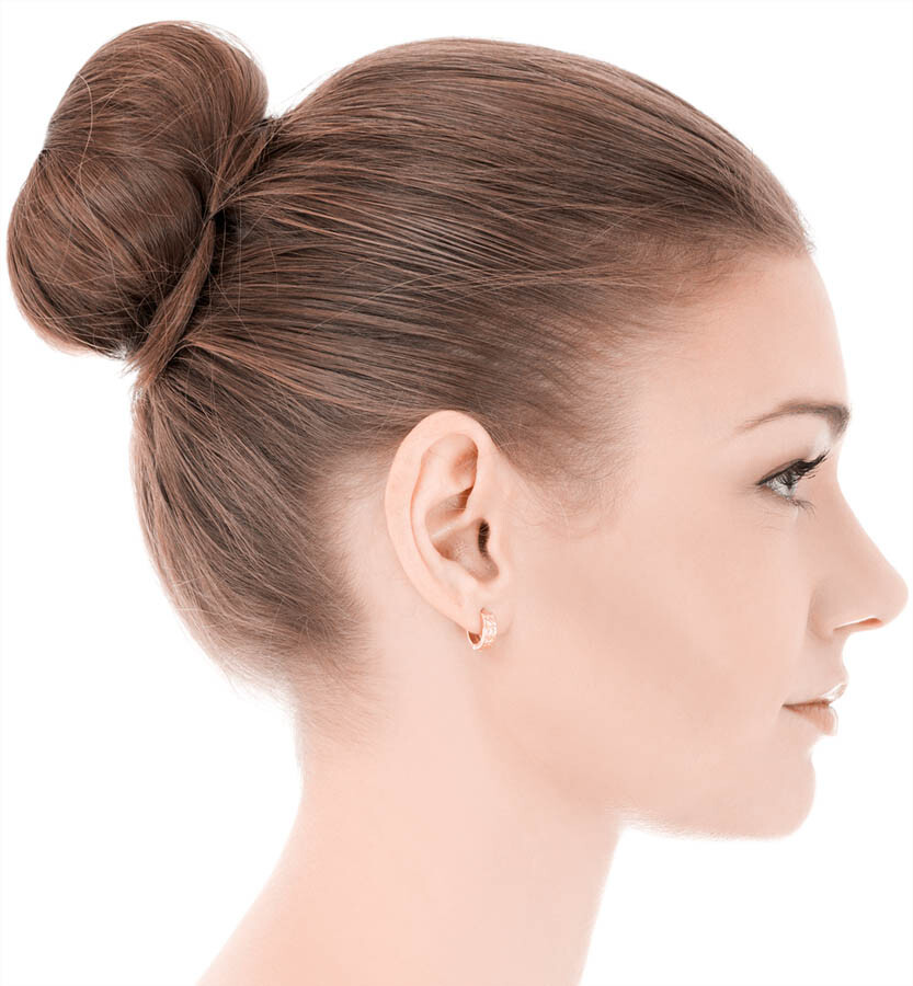 Kybella Results Over Time At 6 Months