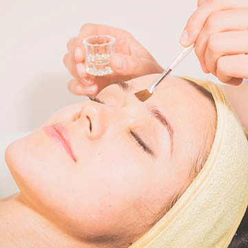 Chemical Peel Photo