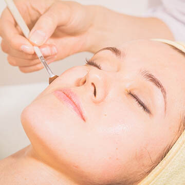 Chemical Peel Treatment Photo