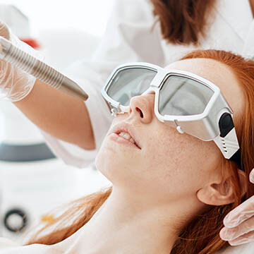 Fractional Laser Resurfacing Treatment Photo