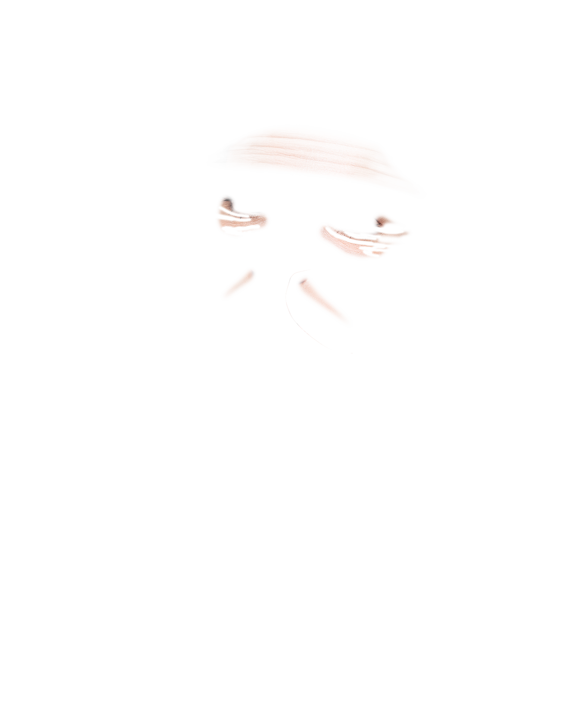 Fractional Laser Resurfacing Treatment Wrinkels