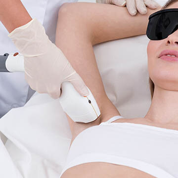 Laser Hair Removal Photograph