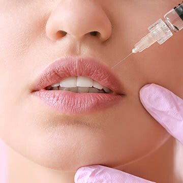 Restylane Application Photo