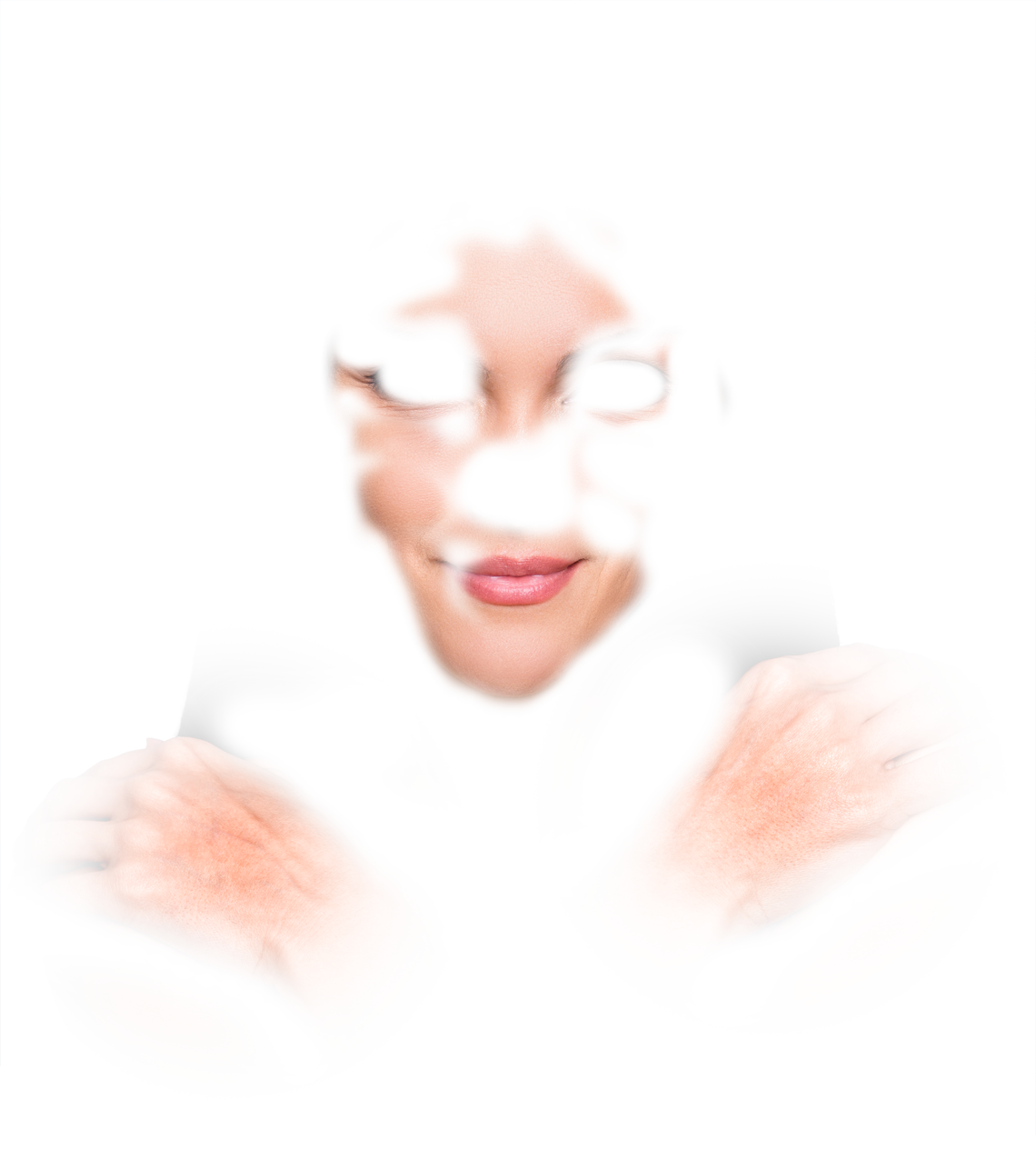 Restylane Lyft Treatment Photo